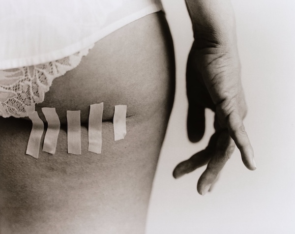 Black and white fine art photograph showing hip with surgical tape strips, lace underwear detail, and relaxed hand. Photography by Axel Schneegass.